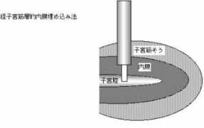 kinutani.org Towako