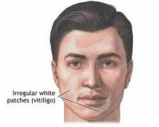 esteticas.com.br Tratamento