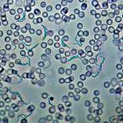 pirx.com Trypanosoma