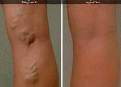 aljoumhouria.com Varise