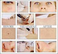 beautyskin.com Vascu