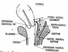 danmartinmd.com Vercellini