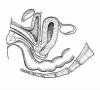 danmartinmd.com Vercellini