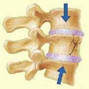 topnews.in Vertebral