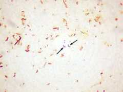 .bakersfieldcollege.edu Vibrio