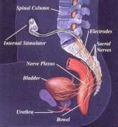 Vocare
