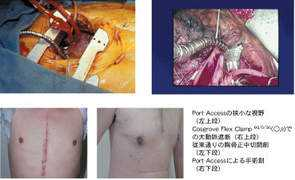 coe-cancer.keio.ac.jp Yozu