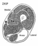 Zasp