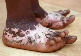 childrenoffire.org Zianda